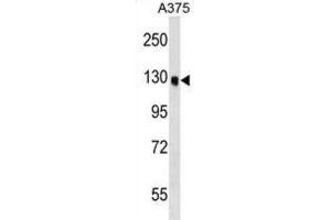 Western Blotting (WB) image for anti-Oxysterol Binding Protein-Like 6 (OSBPL6) antibody (ABIN2999484) (OSBPL6 抗体)