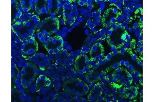 IF analysis of ATP1B1 using anti-ATP1B1 antibody (ABIN7602014).