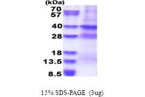 SDS-PAGE (SDS) image for Mediator Complex Subunit 27 (MED27) (AA 1-311) protein (His tag) (ABIN5853665) (MED27 Protein (AA 1-311) (His tag))