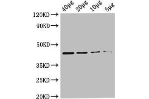 Western Blot Positive WB detected in: Rosseta bacteria lysate at 40 μg, 20 μg, 10 μg, 5 μg All lanes: metC antibody at 0. (MetC (AA 1-392) 抗体 (Biotin))