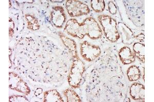 Immunohistochemistry (Paraffin-embedded Sections) (IHC (p)) image for anti-Sodium Channel, Nonvoltage-Gated 1 alpha (SCNN1A) (AA 201-300) antibody (ABIN682243)