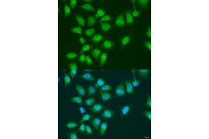 Immunofluorescence analysis of U2OS cells using EY antibody (ABIN7267073) at dilution of 1:100. (EYA3 抗体  (AA 1-300))