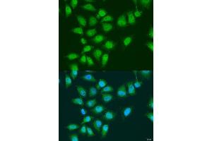 Immunofluorescence analysis of U2OS cells using EY antibody (ABIN7267073) at dilution of 1:100. (EYA3 抗体  (AA 1-300))