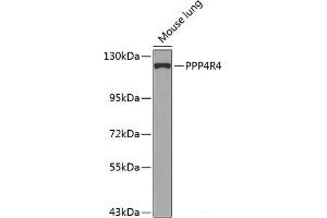 Western blot analysis of extracts of Mouse lung using PPP4R4 Polyclonal Antibody at dilution of 1:1000. (PPP4R4 抗体)