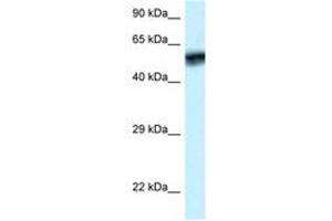 Image no. 1 for anti-Calcium/calmodulin-Dependent Protein Kinase IV (CAMK4) (AA 53-102) antibody (ABIN6747334) (CAMK4 抗体  (AA 53-102))
