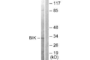 Western blot analysis of extracts from A549 cells, treated with DMSO (0. (BIK 抗体  (Thr33))
