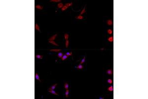 Immunofluorescence analysis of NIH/3T3 cells using CD40L antibody (ABIN6133614, ABIN6138190, ABIN6138191 and ABIN6216826) at dilution of 1:100. (CD40 Ligand 抗体  (AA 79-129))