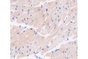Figure. (Coagulation Factor VIII-Associated 1 (F8A1) (AA 171-375) 抗体)