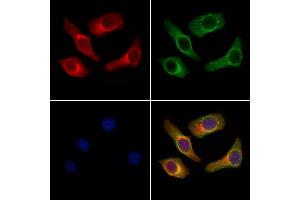 ABIN7094780 and ABIN7098831 staining Hela cells by IF/ICC.