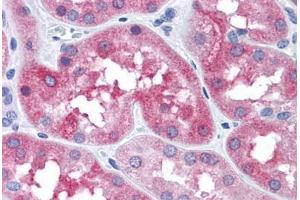 Human Kidney: Formalin-Fixed, Paraffin-Embedded (FFPE) (MAPT 抗体  (Ser404))