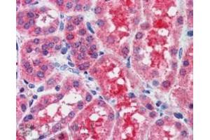Image no. 3 for anti-Suppressor of Cytokine Signaling 1 (SOCS1) (C-Term) antibody (ABIN374072) (SOCS1 抗体  (C-Term))