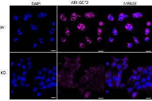 Immunocytochemical staining of HeLa cells using ARHGEF2 antibody (ABIN7800207), 1:1,000), Top panel: wild-type (WT), Bottom panal: ARHGEF2 shRNA knockdown (KD).