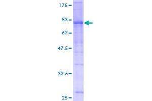 USP25 Protein (AA 1-450) (GST tag)
