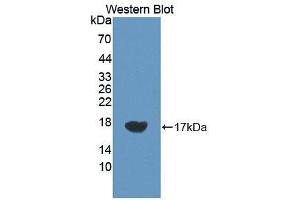 Western blot analysis of the recombinant protein. (VEGFC 抗体  (AA 212-327))