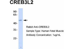 Western Blotting (WB) image for anti-CAMP Responsive Element Binding Protein 3-Like 2 (CREB3L2) (N-Term) antibody (ABIN2775946)