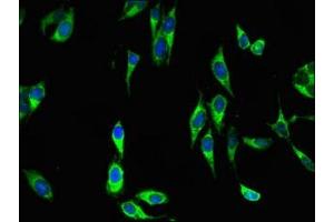 Immunofluorescent analysis of Hela cells using ABIN7150756 at dilution of 1:100 and Alexa Fluor 488-congugated AffiniPure Goat Anti-Rabbit IgG(H+L) (DUSP19 抗体  (AA 1-217))