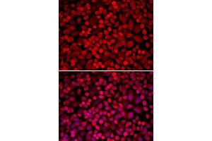 Immunofluorescence analysis of U20S cell using NCOA1 antibody. (NCOA1 抗体  (AA 1222-1441))