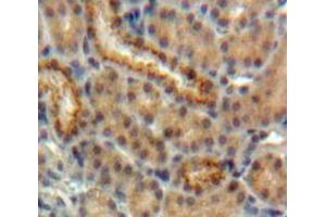 Used in DAB staining on fromalin fixed paraffin-embedded Kidney tissue (EPO 抗体  (AA 28-192))
