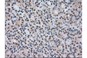 Image no. 6 for anti-Cancer/testis Antigen 1B (CTAG1B) antibody (ABIN1499905) (CTAG1B 抗体)