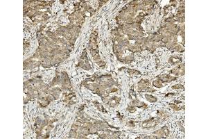 IHC analysis of Methylmalonyl Coenzyme A using anti-Methylmalonyl Coenzyme A antibody (ABIN7603112). (MUT 抗体  (N-Term))