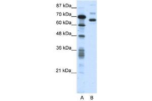 WB Suggested Anti-CTCFL  Antibody Titration: 0. (CTCFL 抗体  (N-Term))