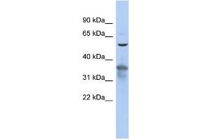 WB Suggested Anti-RAB3IP Antibody Titration: 0. (RAB3IP 抗体  (N-Term))