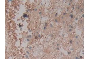 Immunohistochemistry (IHC) image for anti-Cylindromatosis (Turban Tumor Syndrome) (CYLD) (AA 170-338) antibody (ABIN7434896)