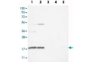 Western blot analysis of Lane 1: RT-4, Lane 2: U-251 MG, Lane 3: Human Plasma, Lane 4: Liver, Lane 5: Tonsil with RPS25 polyclonal antibody  at 1:100 - 1:250 dilution. (RPS25 抗体)
