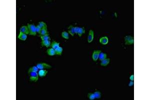 Immunofluorescent analysis of MCF-7 cells using ABIN7154707 at dilution of 1:100 and Alexa Fluor 488-congugated AffiniPure Goat Anti-Rabbit IgG(H+L) (GNAS 抗体  (AA 1-394))