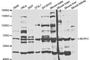 Western blot analysis of extracts of various cell lines, using MCPH1 antibody (ABIN5973185) at 1/1000 dilution. (MCPH1 抗体)