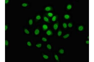 Immunofluorescence staining of A549 cells with ABIN7150334 at 1:100, counter-stained with DAPI. (MCM4 抗体  (AA 2-141))
