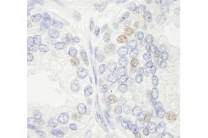 Immunohistochemistry (IHC) image for anti-Excision Repair Cross-Complementing Rodent Repair Deficiency, Complementation Group 4 (ERCC4) (AA 855-905) antibody (ABIN7448869)