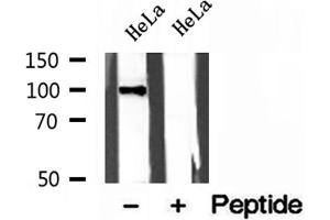 Western blot analysis of extracts of HeLa cells, using LONP1 antibody. (LONP1 抗体  (C-Term))