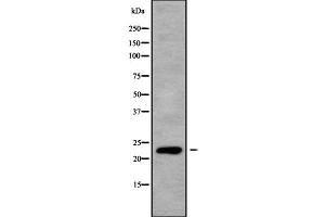 Western blot analysis of RALB using K562 whole cell lysates (RALB 抗体  (C-Term))