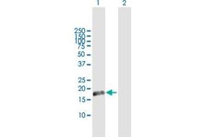 Western Blot analysis of CETN1 expression in transfected 293T cell line by CETN1 MaxPab polyclonal antibody. (Centrin 1 抗体  (AA 1-172))