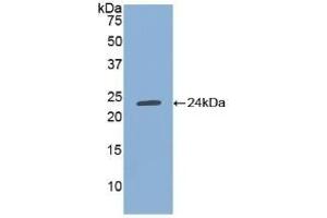 Detection of Recombinant TIMP1, Human using Polyclonal Antibody to Tissue Inhibitors Of Metalloproteinase 1 (TIMP1) (TIMP1 抗体  (AA 25-207))
