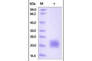 Cynomolgus CTLA-4, His Tag on SDS-PAGE under reducing (R) condition. (CTLA4 Protein (AA 37-160) (His tag))