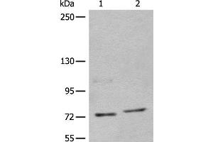 Western blot analysis of 562 and Jurkat cell lysates using NCAPH Polyclonal Antibody at dilution of 1:450 (NCAPH 抗体)