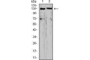 Western blot analysis using OTUD4 mouse mAb against HepG2 (1) and C6 (2) cell lysate. (OTUD4 抗体  (AA 815-1049))