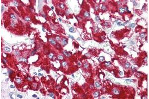 Human Adrenal (formalin-fixed, paraffin-embedded) stained with BAG1 antibody ABIN214400 at 2.