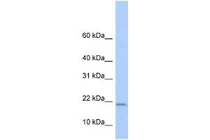 WB Suggested Anti-POLR1D Antibody Titration:  0. (POLR1D 抗体  (Middle Region))