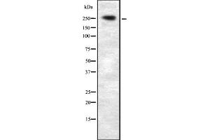 Western blot analysis of PLCE1 expression in HEK293 cells ,The lane on the left is treated with the antigen-specific peptide. (PLCE1 抗体)