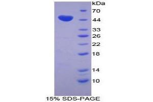 SDS-PAGE analysis of Cow Chromogranin B Protein. (CHGB 蛋白)