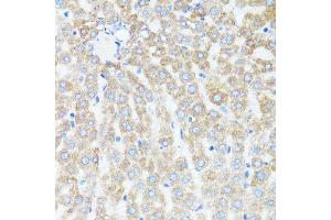 Immunohistochemistry of paraffin-embedded rat liver using CYCS antibody.