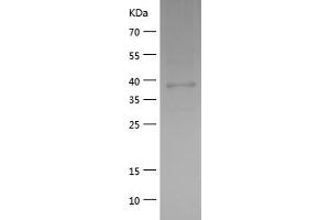 Western Blotting (WB) image for Fibronectin Type III Domain Containing 5 (FNDC5) (AA 32-143) protein (His-IF2DI Tag) (ABIN7122962) (FNDC5 Protein (AA 32-143) (His-IF2DI Tag))