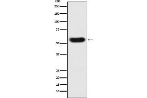 Western blot analysis of SERPINC1 expression in human plasma lysate.