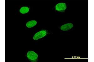 Immunofluorescence of purified MaxPab antibody to ARID3B on HeLa cell. (ARID3B 抗体  (AA 1-253))