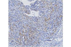 IHC analysis of STAT1 using anti STAT1 antibody (ABIN6719375).