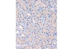 Immunohistochemistry of paraffin-embedded Mouse kidney using MTMR8 Rabbit pAb (ABIN7268766) at dilution of 1:100 (40x lens). (MTMR8 抗体  (AA 430-560))