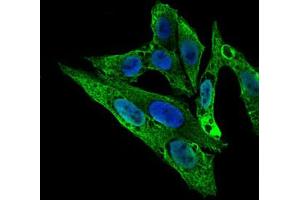Image no. 1 for anti-rho GDP Dissociation Inhibitor (GDI) alpha (ARHGDIA) antibody (ABIN1500701) (ARHGDIA 抗体)